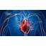 Coronary Heart Disease  Consumer Health News HealthDay