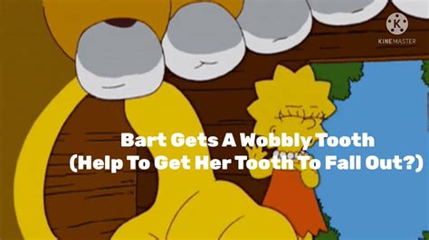 Bart Gets A Wobbly Tooth How To Get Her Tooth Out Youtube