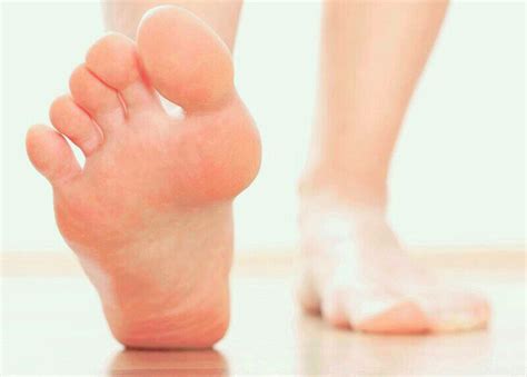 Sweaty Feet Symptoms Causes Treatment Prevention
