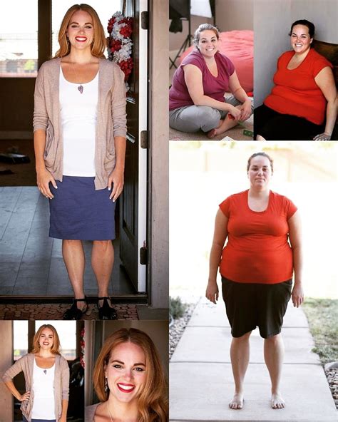 Weight Loss Surgery Before After