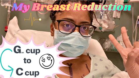 breast reduction journey why i did it and 1 week post op update youtube