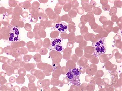 A Normal Peripheral Blood Smear Download Scientific D