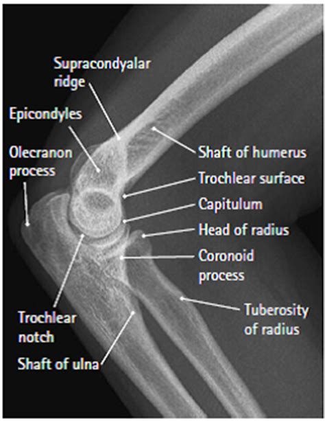 Medical Imaging Technology Radiographic Anatomy Of Elbow