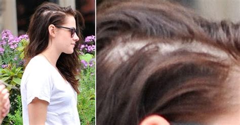 When she is all done up and styled you cannot see the damage, but when she is in her natural state her hair just looks like a damaged rats nest. Hair Loss in Women: Dr Reddy of The Private Clinic talks ...