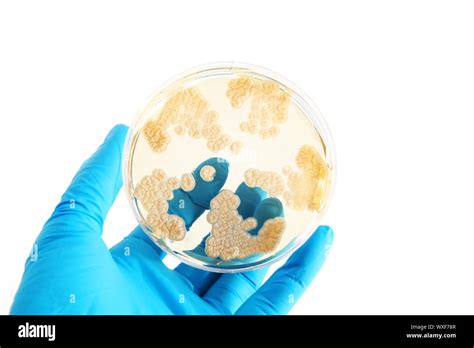 Fungi Microorganisms On Agar Plate In Laboratory Stock Photo Alamy