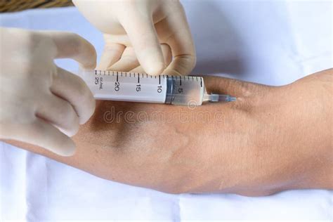 Injection Into A Vein Stock Image Image Of Analyzing 72777485