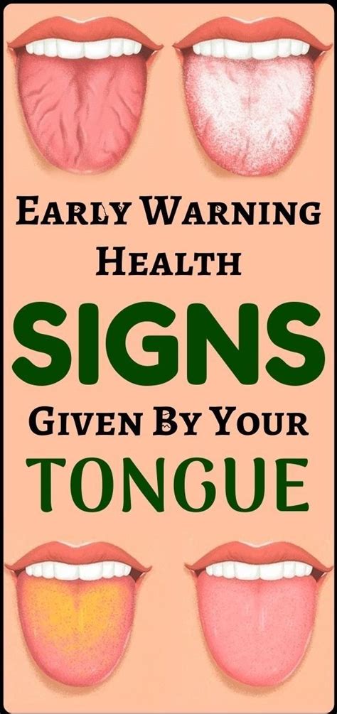 Early Warning Health Signs Given By Your Tongue Wellness Days