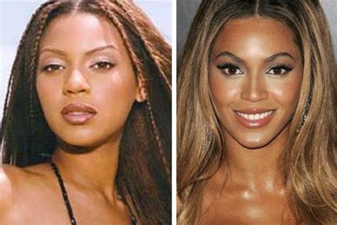 Bey Has Grown Into A Beautiful Woman Beyonce Plastic Surgery