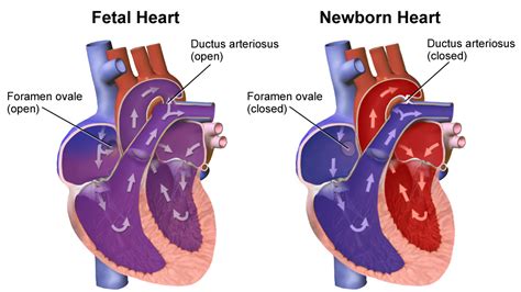 Foramen Ovale And Ductus Arteriosus Fetal Circulation Differences All