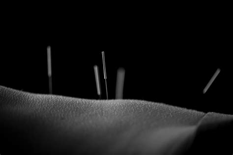 The Future Of Acupuncture Apex Acupuncture