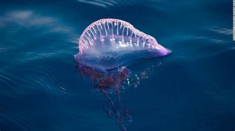 Bluebottle Jellyfish Sting Thousands On Queensland Beaches Cnn