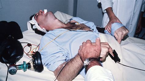 Electroconvulsive Therapy 1950s