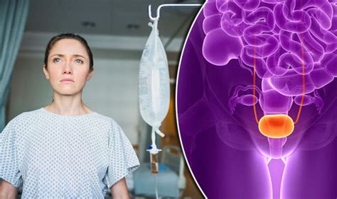 Urinary Tract Infection Hospital Medical Device Could Reduce UTI Risk Health Life Style