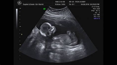 16 Weeks Baby Scan 4d And Gender Scan Girl Or Boy Youtube
