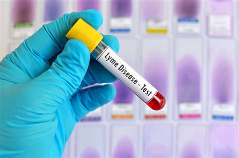 Lyme Disease Tests Learn About The Lyme Tests Available