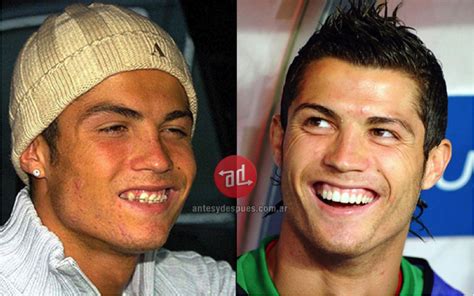 Cristiano Ronaldo Before After