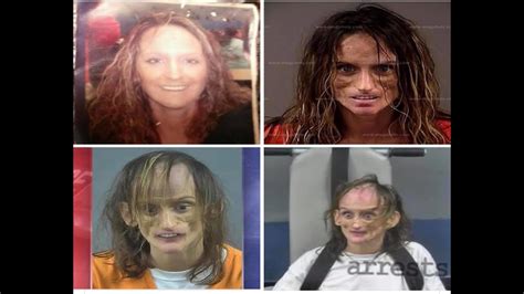 Misty Loman Shocking Before And After Photos Youtube