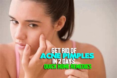 Cure Acne Pimples In 2 Days 30 Home Remedies For Acne And Irritating