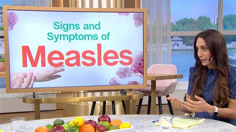 Everything You Need To Know About Measles This Morning