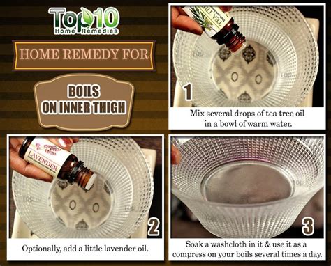 How To Get Rid Of Boils On Inner Thigh Top 10 Home Remedies