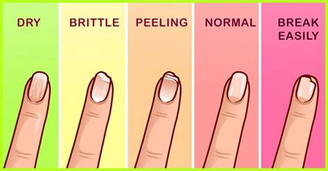 How To Make Your Nails Grow Faster And Stronger Naturally At Home