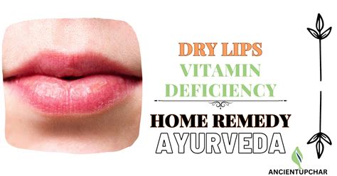 Dry Lips Vitamin Deficiency Home Remedy Ancientupchar