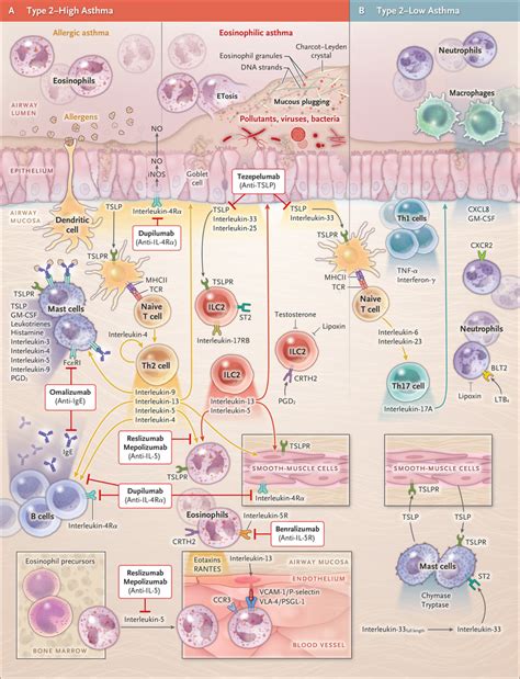 Biologic Therapies For Severe Asthma Nejm