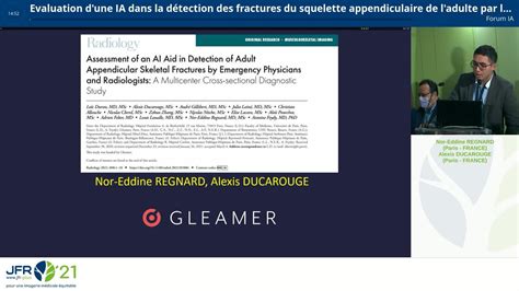 Evaluation D Une Ia Dans La D Tection Des Fractures Du Squelette Appendiculaire De L Adulte Par