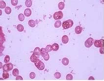 Haemophilus influenzae can cause many kinds of infections. Haemophilus influenzae