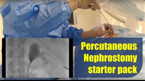 Percutaneous Nephrostomy Procedure And Technique Starter Pack Youtube