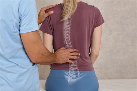 What Can Physical Therapy Do For Scoliosis And Where To Take It