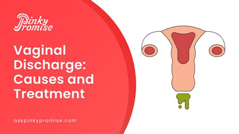 Vaginal Discharge Cause And Treatment Expert Advice And Solutions