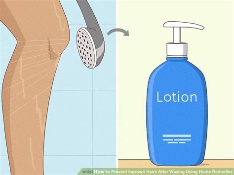 11 Simple Ways To Prevent Ingrown Hairs After Waxing Using Home Remedies