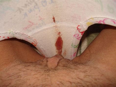 Virgin Pussy Menstruation Blood Which Out Porn Archive Free Comments