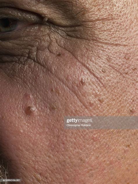 Age Spots And Wrinkles On Senior Mans Skin Closeup Stock Foto Getty