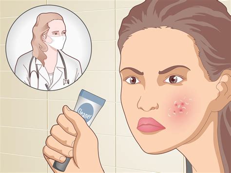 4 Ways To Prevent Acne Naturally Wikihow
