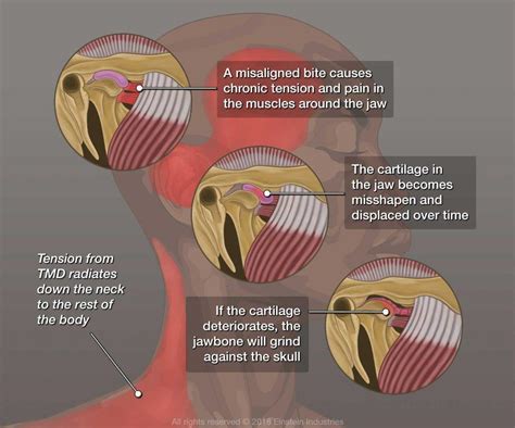 Tmj Treatment In Cary Nc Parkway Professional Park Cary Nc Cary Smiles