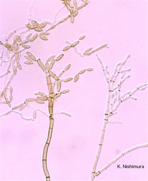 Cladosporium Cladosporioides Microscopy