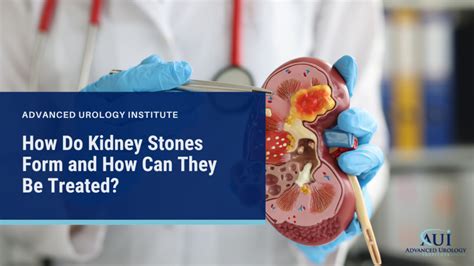 How Do Kidney Stones Form And How Can They Be Treated