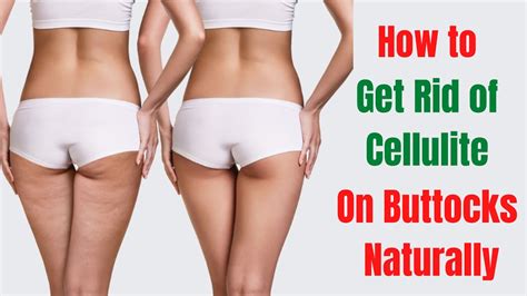 Exercise To Get Rid Of Cellulite On Buttocks Tips For Cellulite On