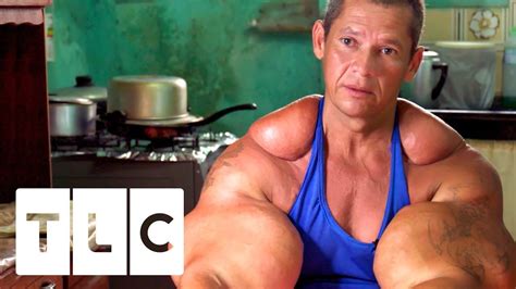 Bodybuilders Inject Muscles With Oil Real Life Hulks Https