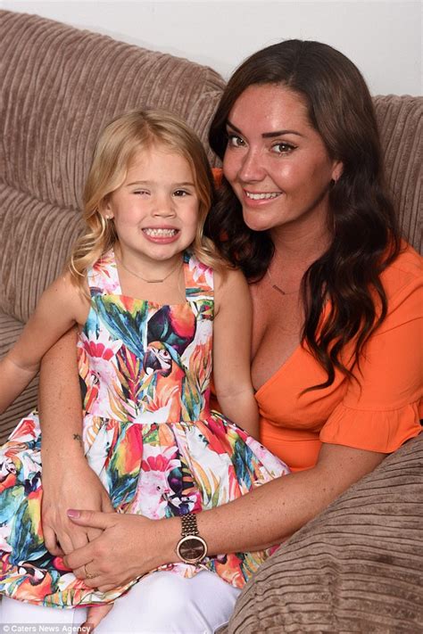 Uk Girl Born Without An Eye Has One Created From Her Own Stomach Fat