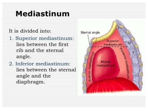 Mediastinal Anatomy Classification Of Mediastinal Masses Ans Its Loc