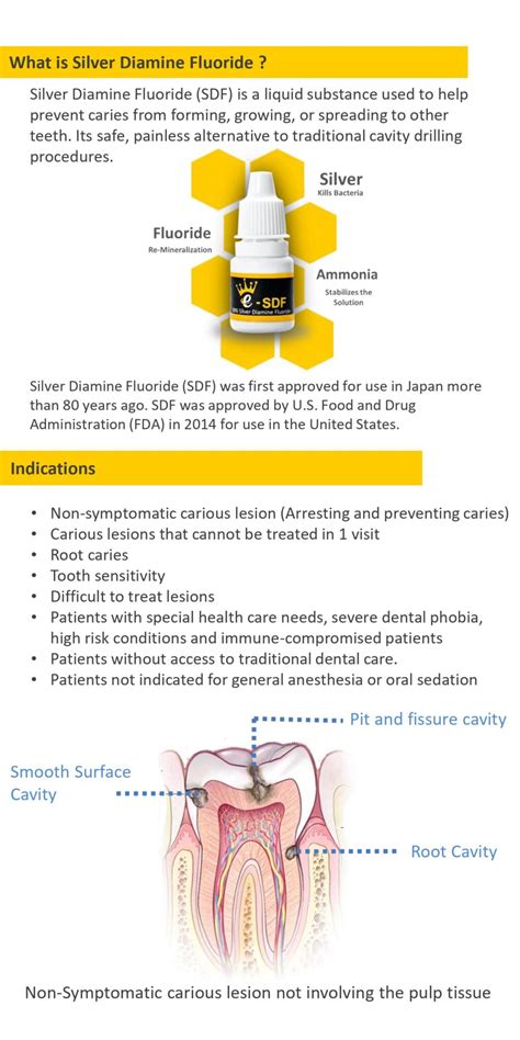 Buy E Sdf Dental Silver Diamine Fluoride Esdf Caries Protector Online