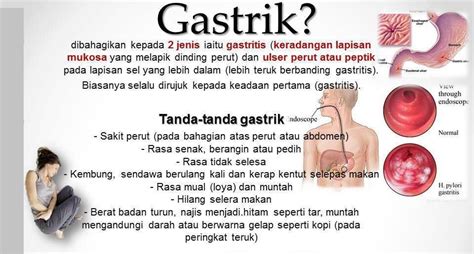 Check spelling or type a new query. 7 Tips Khas Untuk Pengidap Gastrik Kalau Tak Nak Sakit ...