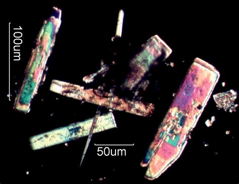 Quartz is the second most abundant mineral found in the earth's crust, after feldspar. Urea Crystals Under the Microscope