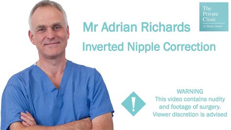 Inverted Nipples Correction With Mr Adrian Richards Youtube