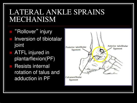 Ppt Ankle Lateral Ligament Injuries And Reconstruction Powerpoint