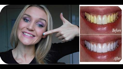 How To Get Really White Teeth In Just 2weeks Guaranteed Youtube