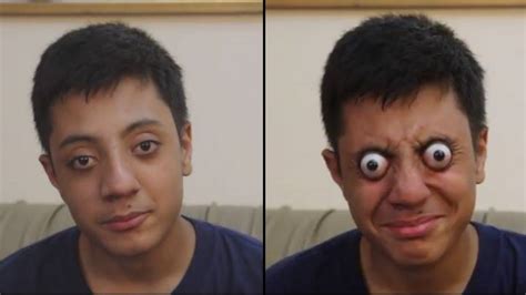 Teen Can Bizarrely Pop His Eyes Out Of His Head For One Minute Ladbible